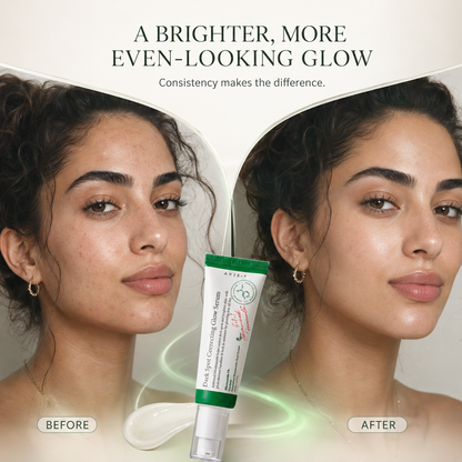 Dark Spot Correcting Glow Serum